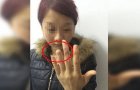 甘肃2警察强拉23岁女子陪酒 女方不从被打断手指(图)