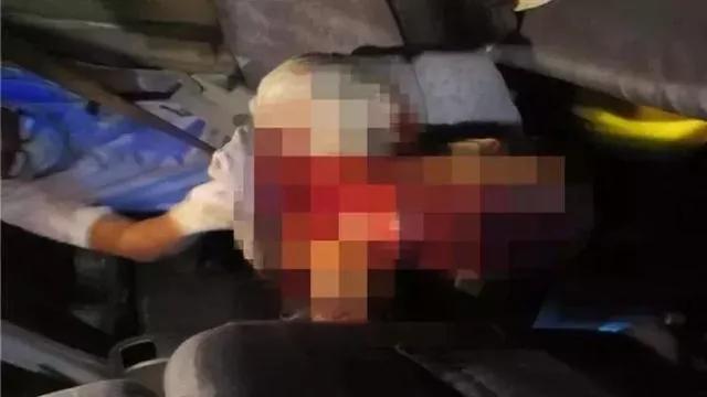 大陆一男子深夜回家忽然尖叫 接着喉咙被刺穿一个洞