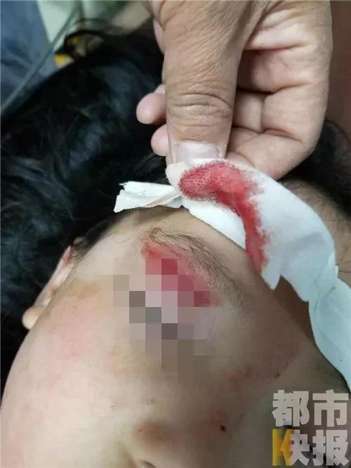 女孩摸了一下仿製兵馬俑 被砸得頭出血腿骨斷裂