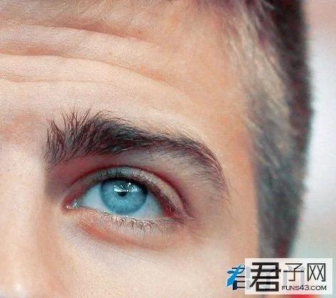 男人也要當心眼部脂肪粒 4 男人也要當心眼部脂肪粒