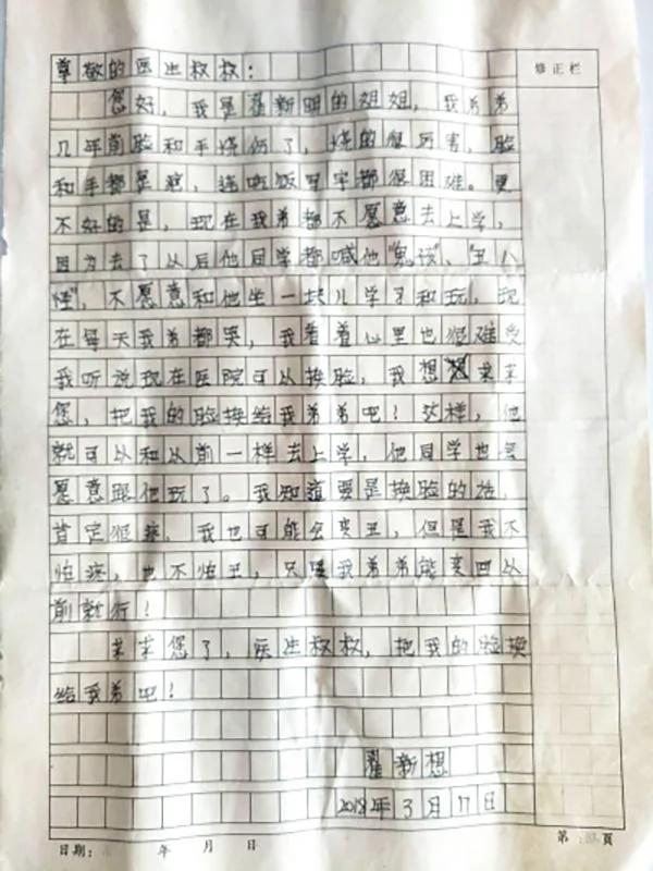 男孩燒傷毀容 14歲姐姐寫信求"換臉" 2 男孩燒傷毀容 14歲姐姐寫信求"換臉"
