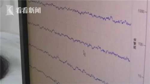 為減肥她吃素30年 現在差點癱了…