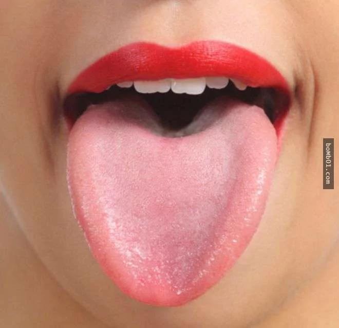 請你馬上檢查看看你的舌頭是否有出現「皺摺」 它會出現的原因一定要知道啊！