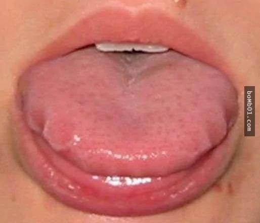請你馬上檢查看看你的舌頭是否有出現「皺摺」 它會出現的原因一定要知道啊！