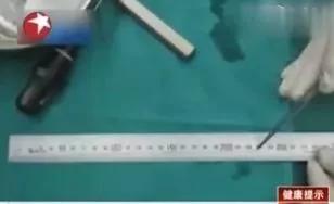 只因為吃了它 男子膽囊上長出上萬顆蟲卵
