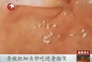 只因為吃了它 男子膽囊上長出上萬顆蟲卵
