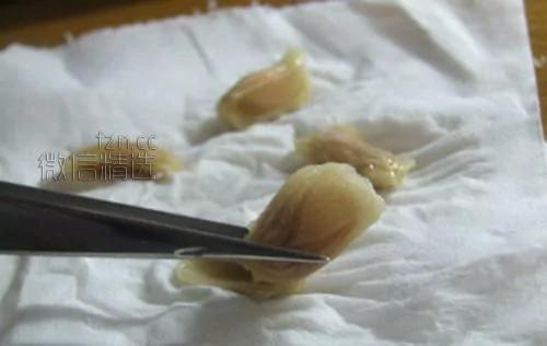 杯子里的森林美哭！你吃剩的果核竟能變成這些 後悔以前白扔了…