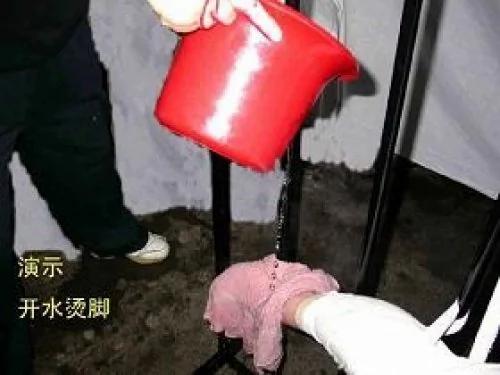 中国民主党反酷刑观察：开水烫脚 毒过蛇蝎的中共酷刑