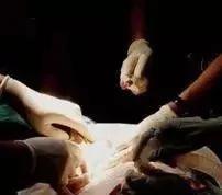 90後小伙為還高利貸4萬元賣腎 "中介人"賺40多萬 6 90後小伙為還高利貸4萬元賣腎 "中介人"賺40多萬