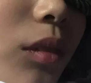 女孩每晚睡覺都被親媽用膠布封嘴 還是醫生的建議