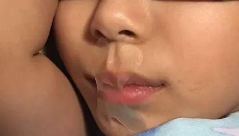 女孩每晚睡覺都被親媽用膠布封嘴 還是醫生的建議