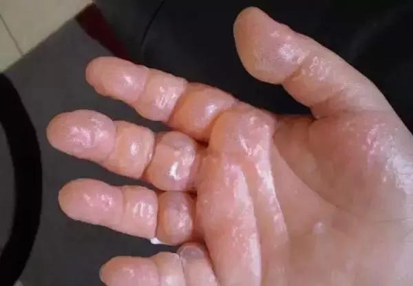加拿大這6種常見花草 輕則過敏 重則奪命！