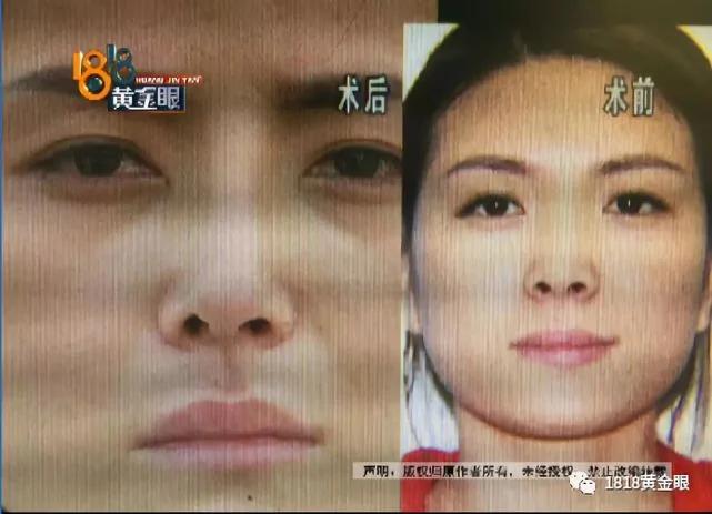 女子做完整形手術後回家 老公要離婚兒子不認她