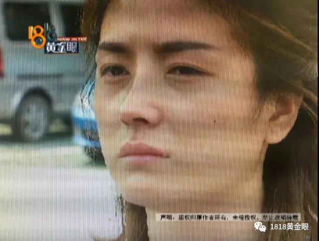 女子做完整形手術後回家 老公要離婚兒子不認她