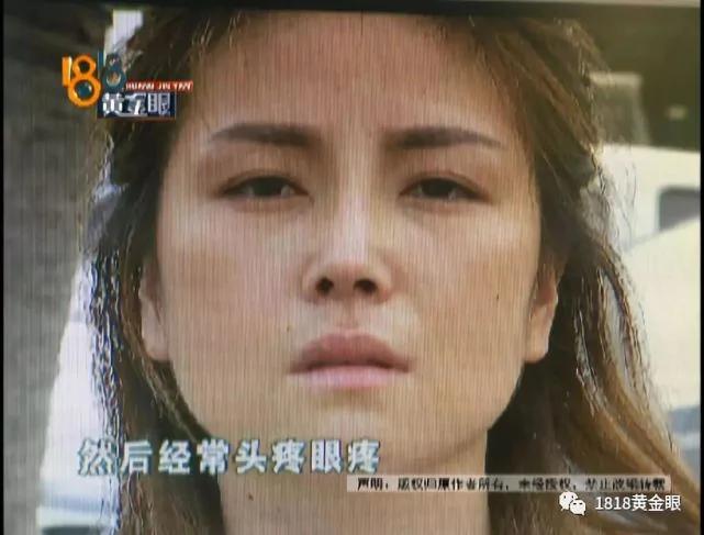 女子做完整形手術後回家 老公要離婚兒子不認她
