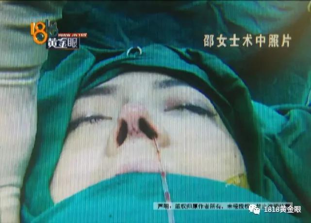 女子做完整形手術後回家 老公要離婚兒子不認她